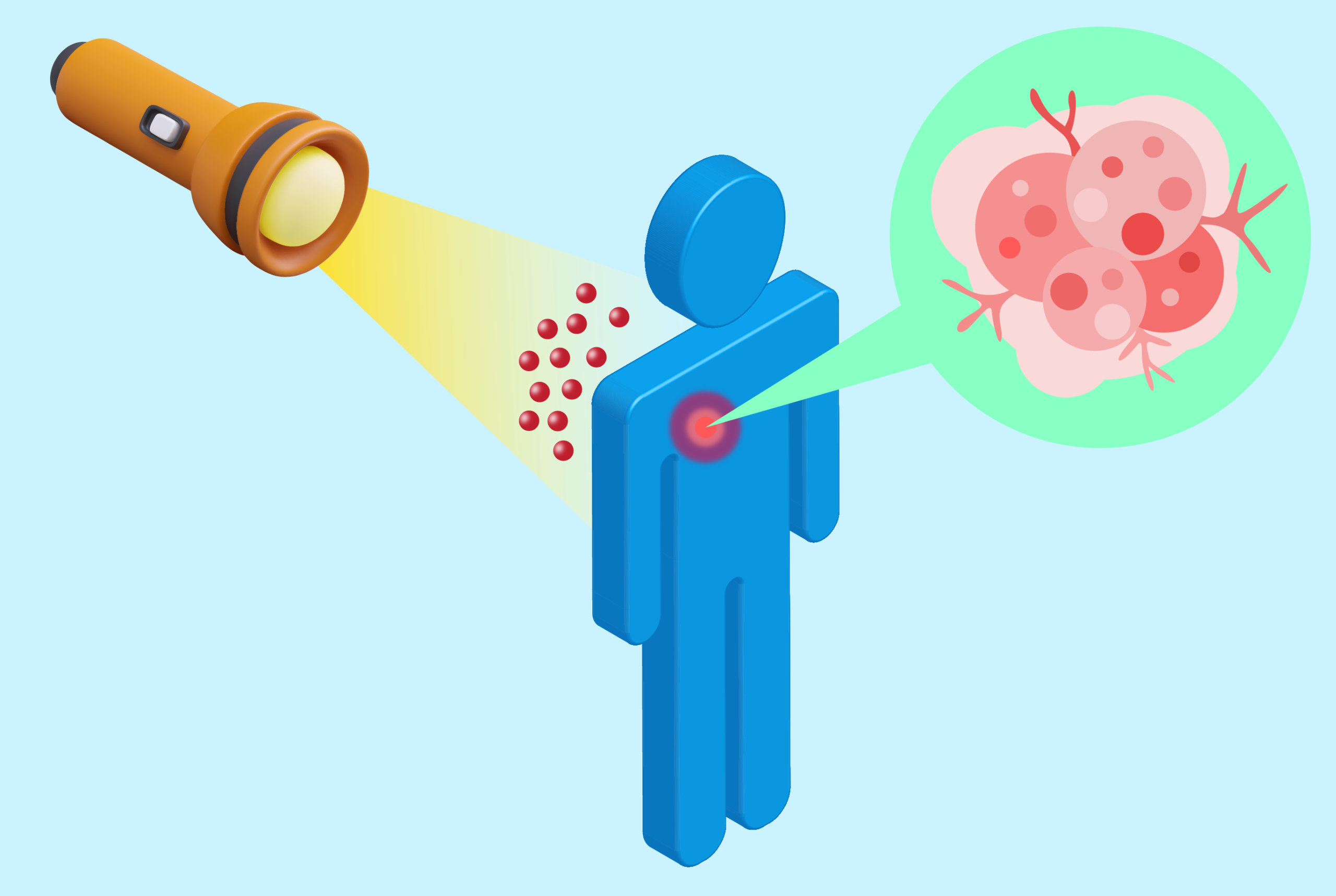 cancer, treatment options, photodynamic therapy